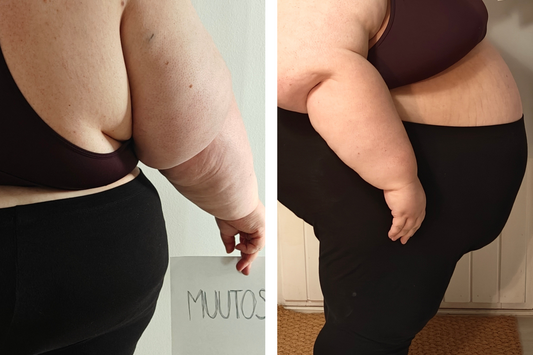 Yksi päätös voi muuttaa elämän: yli 200-kiloisen Jennin tarina