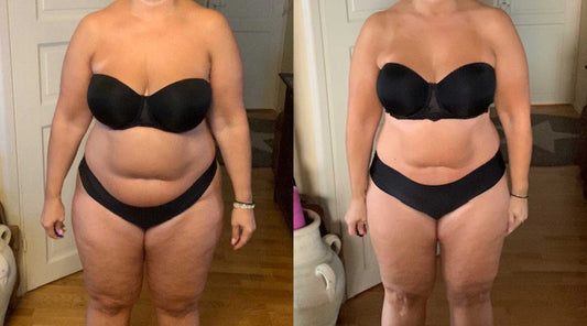 KETO49®: Asiakkaamme onnistui pudottamaan 8 kiloa pelkällä ruokavaliolla!