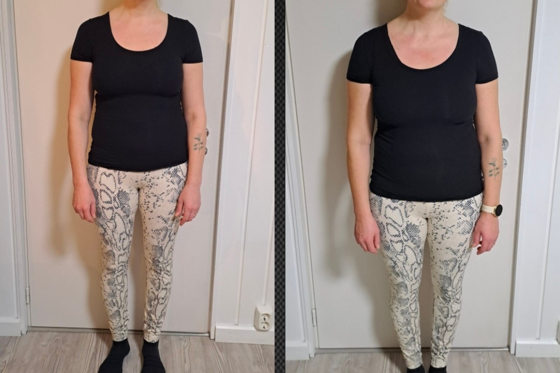 Venla onnistui pudottamaan 5,2 kg Superdieetti Klassikko -valmennuksessa