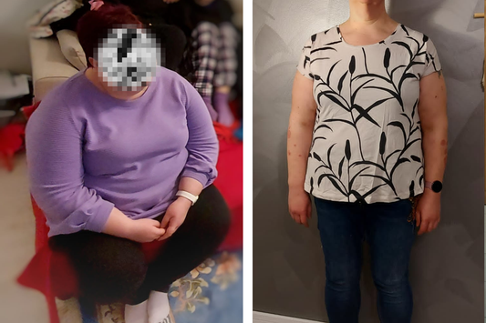 Liisa on pudottanut jo huikeat 35,5 kg Superdieetti XL -valmennuksen avulla
