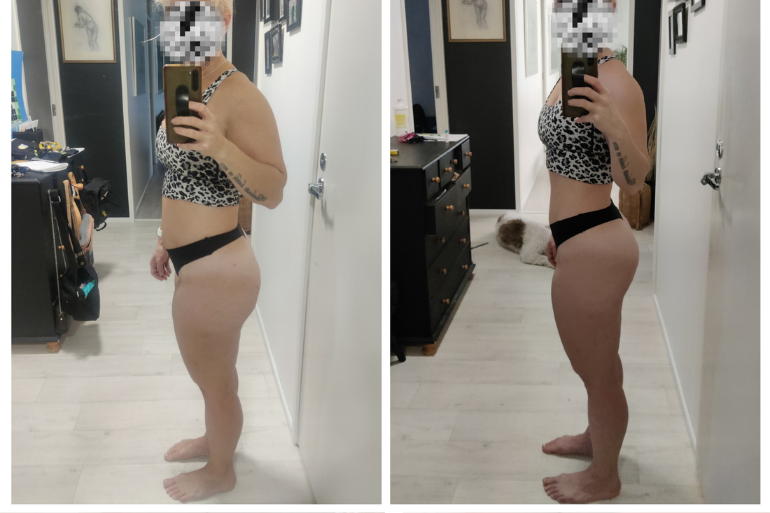 Sanna pudotti “kesäkilot” onnistuneesti Superdieetti -valmennuksella